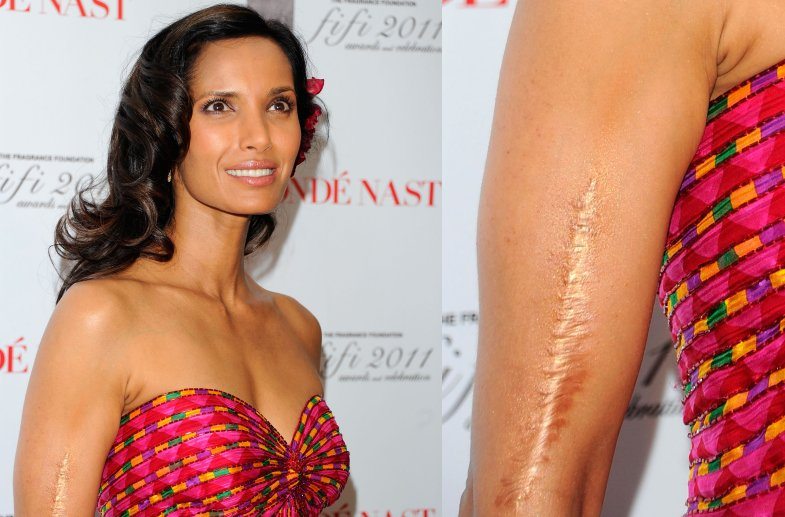 Padma Lakshmi embraces her natural beauty by refusing to cover up or Photos...