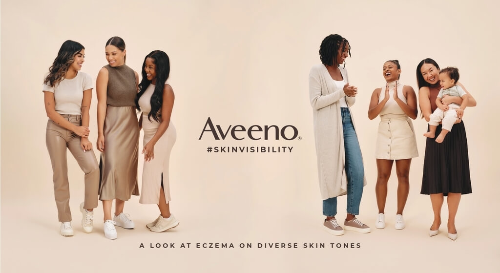 Aveeno® Canada’s New #Skinvisibility Visual Resource Spotlights Eczema on Diverse Skin Tones: Ruchika Karnani. Photo Credit: Aveeno® Canada