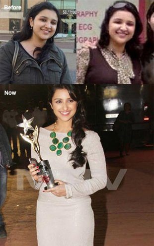 parineeti before after