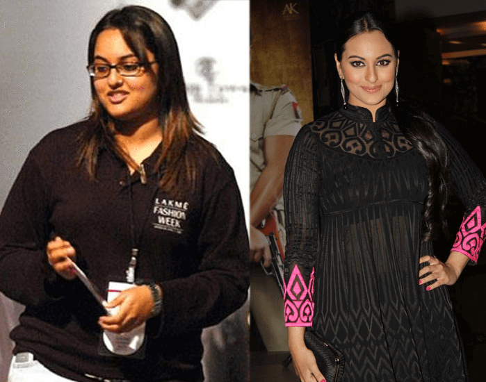 sonakshi before after